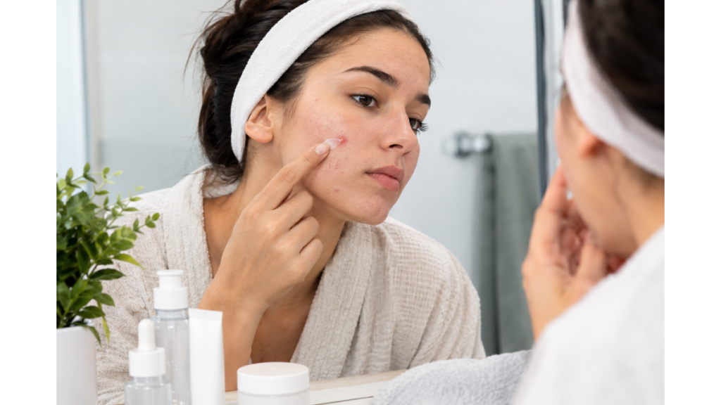 Woman applying skincare cream to pimples on her cheek