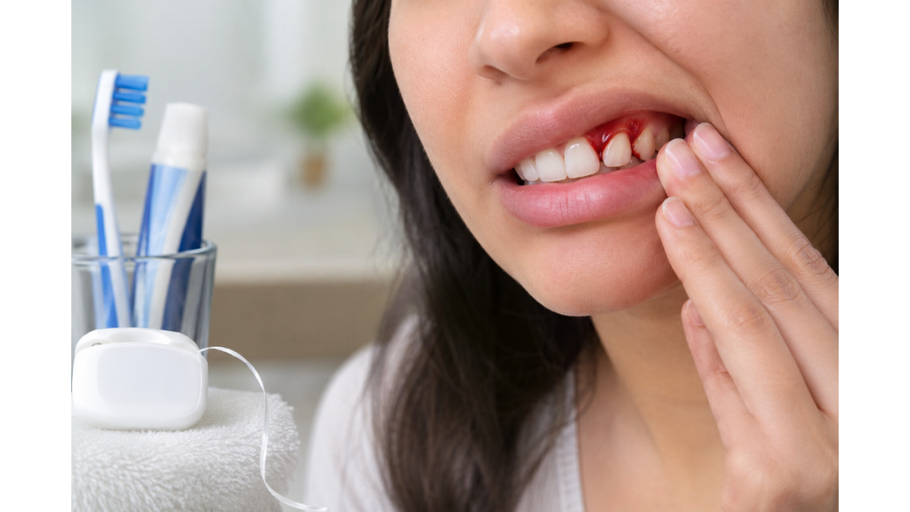 Bleeding gums linked to poor dental hygiene and gum inflammation